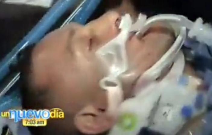 "La situación de Camacho es muy delicada", afirmó el doctor a Telenoticias. "Su condición física le ayudará, pero ya veremos".