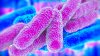 Detectan la bacteria Legionella en hotel de Cupertino