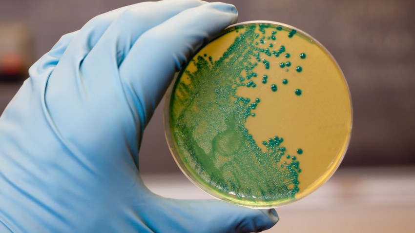 retiro-por-listeria-5