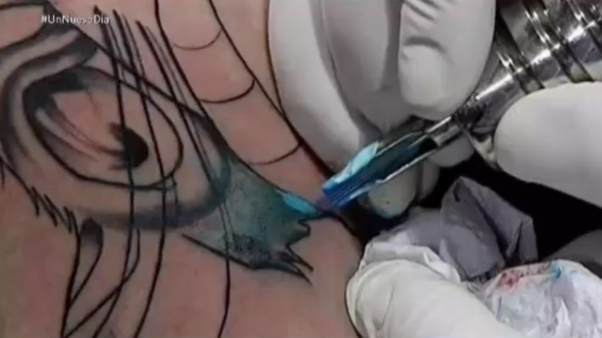 tinta-tatuaje-infecciones