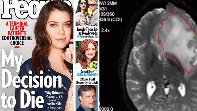 tlmd_brittany_maynard_people