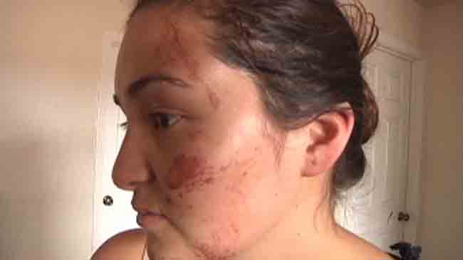 tlmd_brutalidad_policiaca_alameda