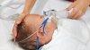Aumentan los casos de VSR entre niños y bebés: estos son los síntomas de alerta