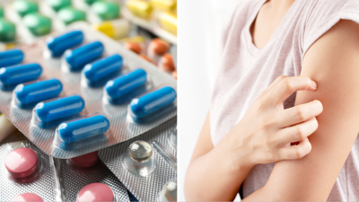 ¿Tomas estas populares medicinas? La FDA advierte sobre una extraña reacción