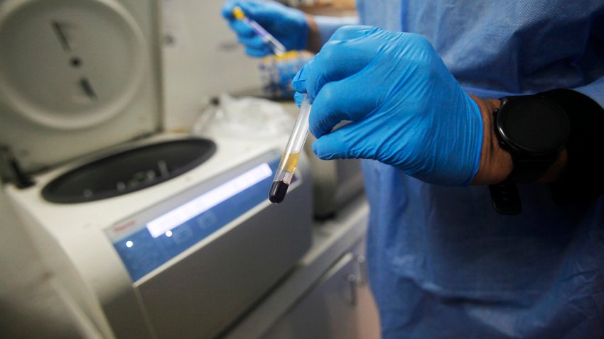 EE.UU. aprueba la primera inyección preventiva para el VIH aplicada cada seis meses