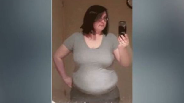 Video: Impactante: pierde 88 lbs en 5 segs